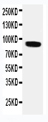 1 - Anti-VRL1 Antibody ABO11285