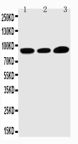 1 - Anti-TRPV3 Antibody ABO11286