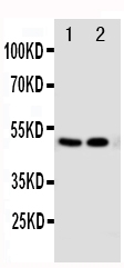 1 - Anti-VDR Antibody ABO11291