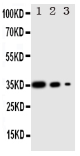 1 - Anti-Wnt2b Antibody ABO11293