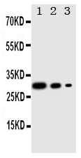 1 - Anti-TORC1 Antibody ABO11295