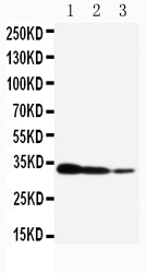 1 - Anti-TORC2 Antibody ABO11296