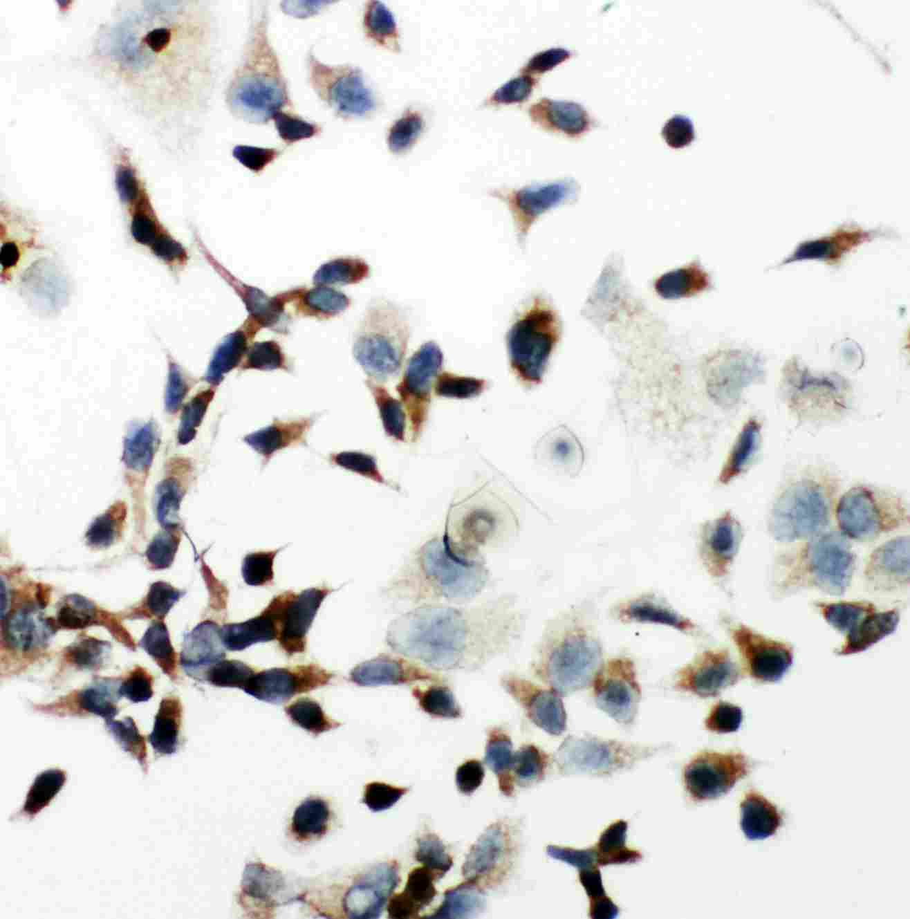 8 - Anti-VEGFR2/KDR Antibody ABO11297