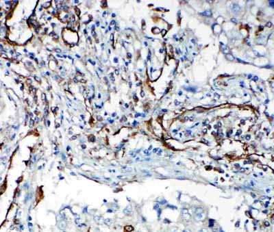 2 - Anti-VEGFR2/KDR Antibody ABO11297