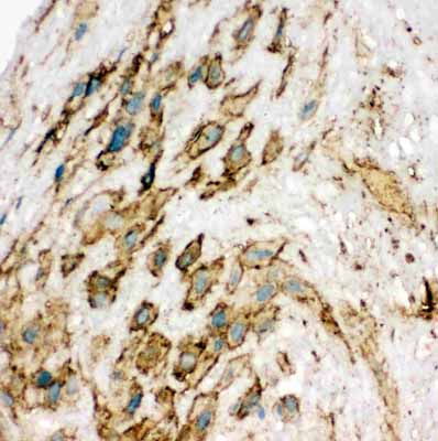 2 - Anti-VEGFR2/KDR Antibody ABO11297