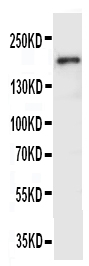 1 - Anti-VEGFR2/KDR Antibody ABO11297