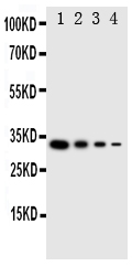 1 - Anti-LTK Antibody ABO11298