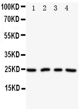 1 - Anti-NPM2 Antibody ABO11299
