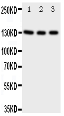1 - Anti-TrkC Antibody ABO11300