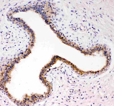 2 - Anti-TrkC Antibody ABO11301