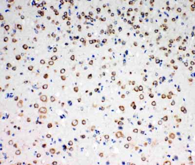 2 - Anti-TrkC Antibody ABO11301