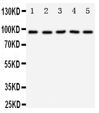 1 - Anti-TrkC Antibody ABO11301