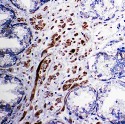 2 - Anti-Mitochondrial Pyruvate Dehydrogenase Kinase 1 Antibody ABO11302