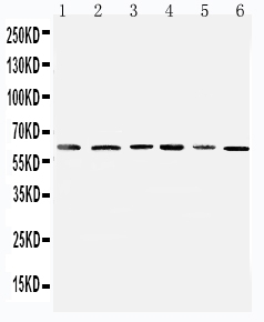 1 - Anti-Mitochondrial Pyruvate Dehydrogenase Kinase 1 Antibody ABO11302