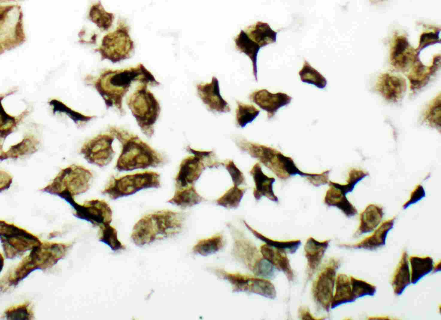 8 - Anti-PDK2 Antibody ABO11303