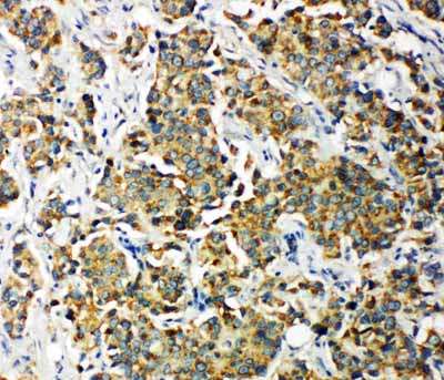 2 - Anti-PDK2 Antibody ABO11303