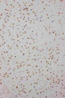 2 - Anti-PDK2 Antibody ABO11303