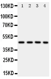 1 - Anti-PDK2 Antibody ABO11303
