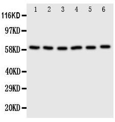 1 - Anti-SCLY Antibody ABO11304