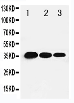 1 - Anti-T-bet/Tbx21 Antibody ABO11308