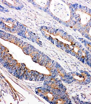 2 - Anti-Tec Antibody ABO11309