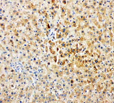 2 - Anti-Tec Antibody ABO11309