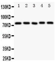 1 - Anti-Tec Antibody ABO11309