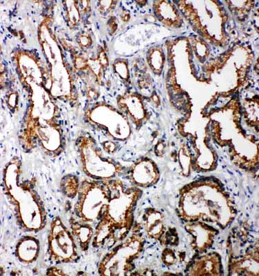 2 - Anti-Tollip Antibody ABO11312