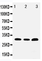 1 - Anti-Tollip Antibody ABO11312