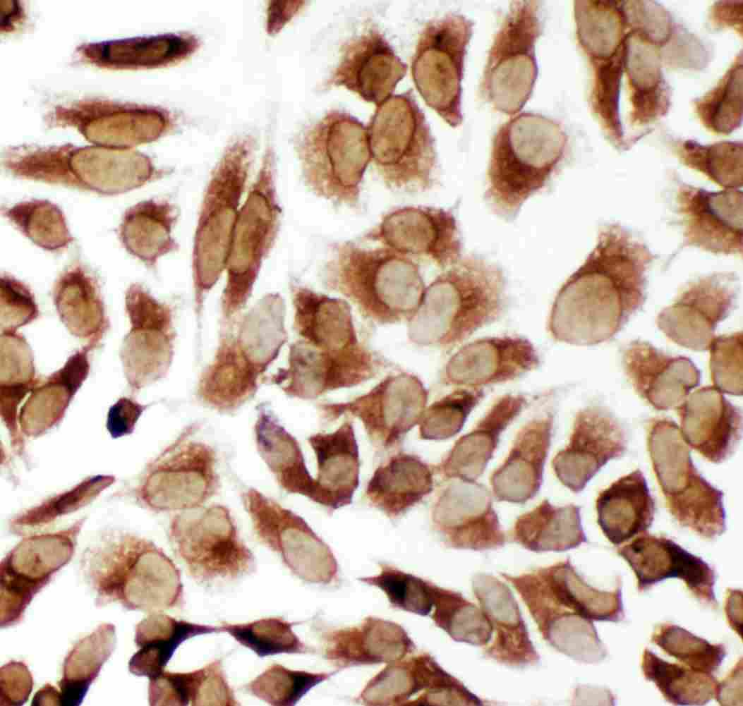 8 - Anti-TRAM1 Antibody ABO11317