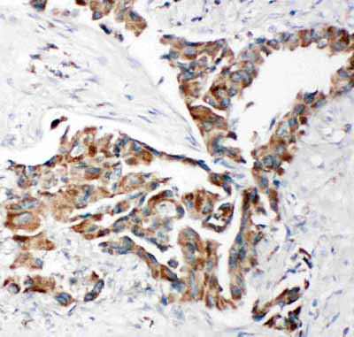 2 - Anti-TRAM1 Antibody ABO11317