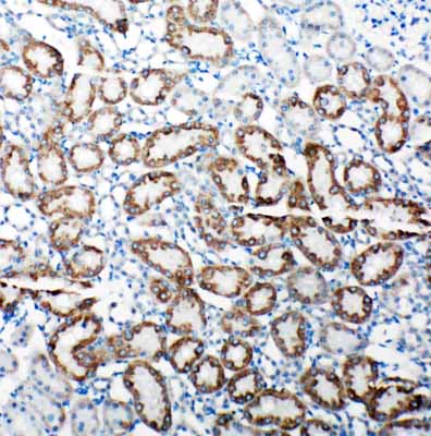 2 - Anti-TRAM1 Antibody ABO11317
