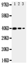 1 - Anti-TRAM2 Antibody ABO11318