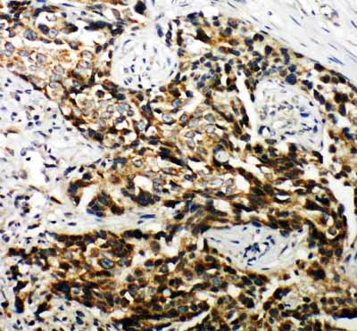 2 - Anti-Hamartin Antibody ABO11319