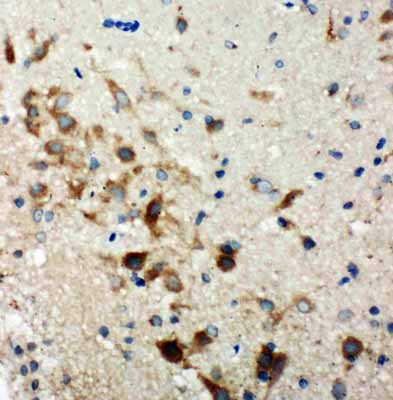 2 - Anti-Hamartin Antibody ABO11319