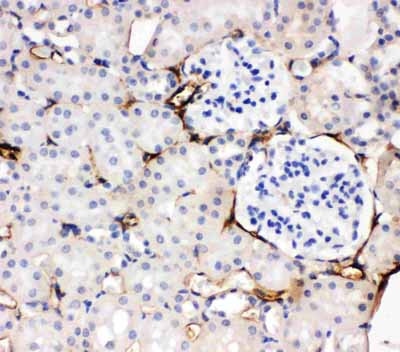 2 - Anti-Adiponectin Antibody ABO11321