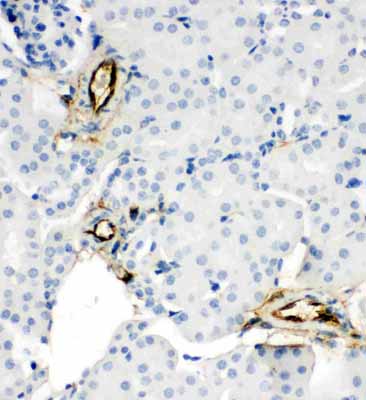 2 - Anti-Adiponectin Antibody ABO11321