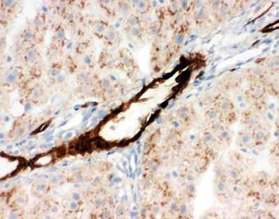 2 - Anti-Adiponectin Antibody ABO11321