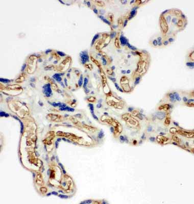2 - Anti-Adiponectin Antibody ABO11321