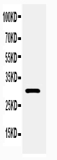 1 - Anti-Adiponectin Antibody ABO11321