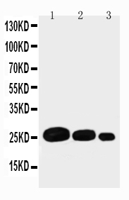 1 - Anti-Adiponectin Antibody ABO11321