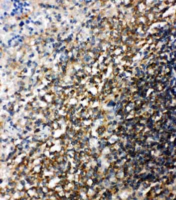 2 - Anti-Bid Antibody ABO11322