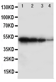 1 - Anti-BMPR1B Antibody ABO11323