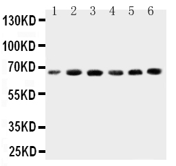 1 - Anti-CETP Antibody ABO11325