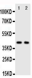 1 - Anti-CXCR5 Antibody ABO11327