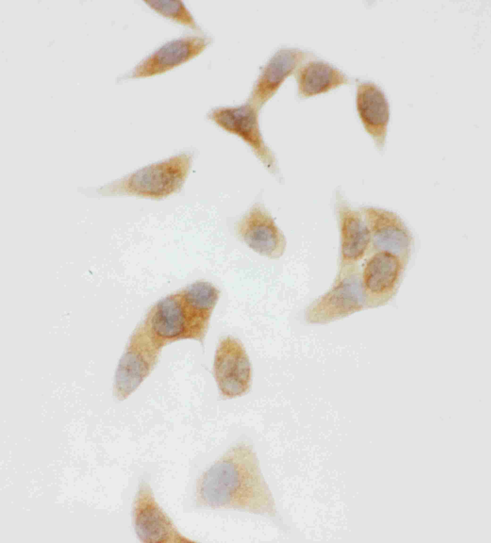8 - Anti-CYP2U1 Antibody ABO11328