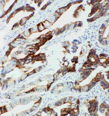 2 - Anti-CYP2U1 Antibody ABO11328