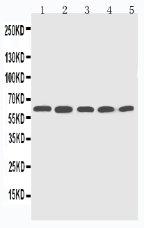 1 - Anti-CYP2U1 Antibody ABO11328