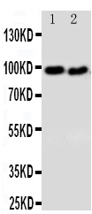 1 - Anti-DISC1 Antibody ABO11329