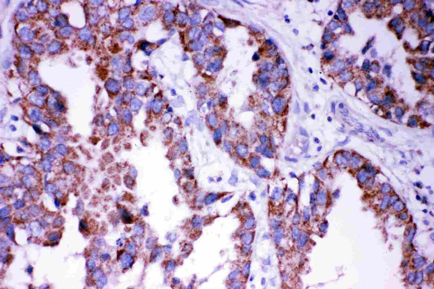 2 - Anti-DISC1 Antibody ABO11330